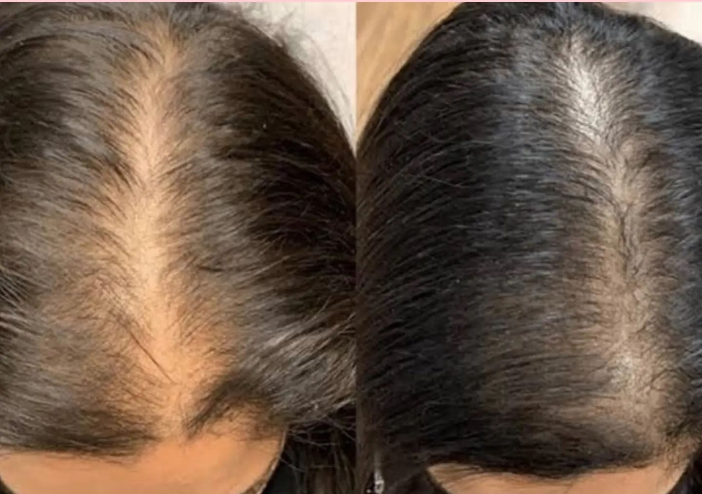 NATURAL NOURISH OIL BY LEAFY